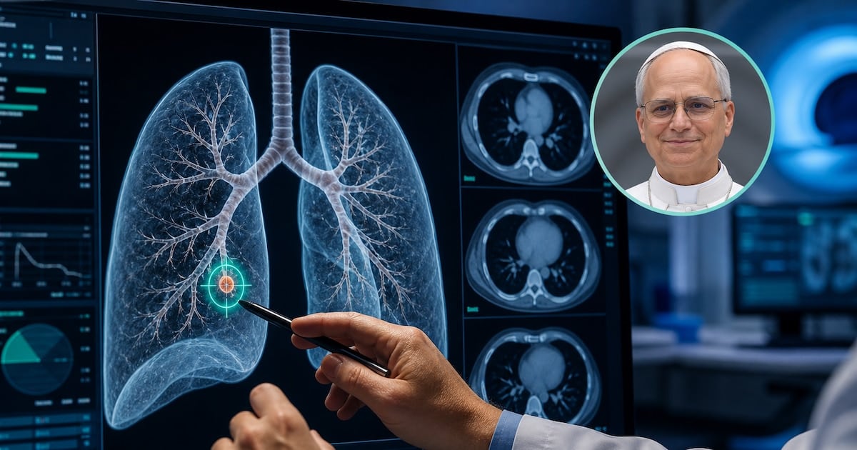 Nódulo pulmonar: por qué a veces conviene sacarlo aunque mida apenas unos milímetros